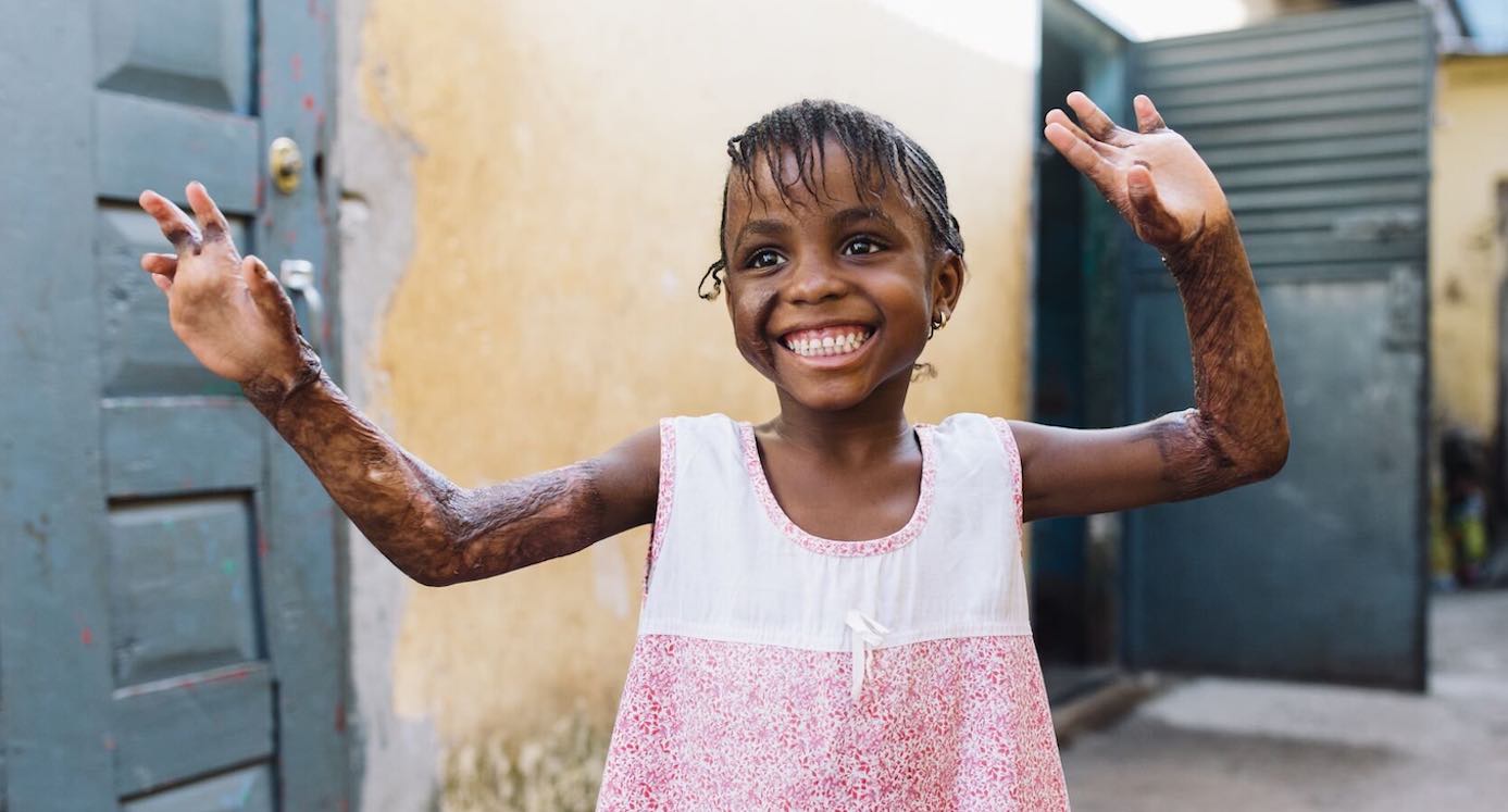 Gamai peut enfin bouger ses bras grâce au traitement de Mercy Ships – SWNS